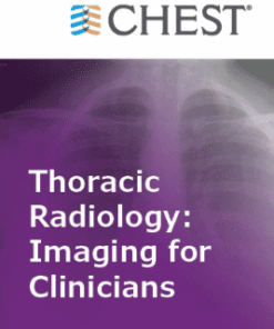 Chestnet Thoracic Radiology: Imaging for Clinicians (Chestnet) 2021 (Videos + Quiz)