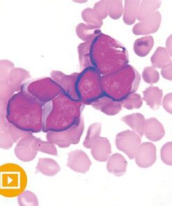 Current Concepts in Hematopathology 2022 ( VIDEOS)