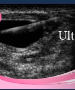 Pegasus Breast Ultrasound video course 2022