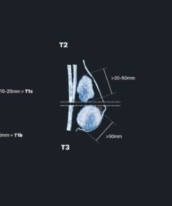 MRIOnline Mastery Series: Evaluation of Newly Diagnosed, Pre-Operative Breast Cancer Patients 2021