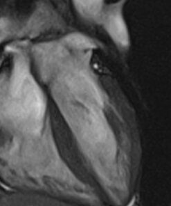 MRIOnline Mastery Series: Cardiac MRI of Non-Ischemic Cardiomyopathy 2021