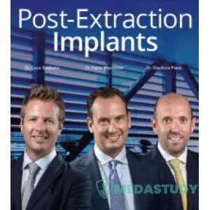 Post-Extraction Implants (Video course)