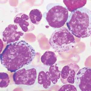 Hematopathology 2021 (CME VIDEOS)