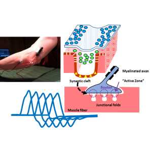 EMG/NCS Online Series: Volume XII Repetitive Nerve Stimulation