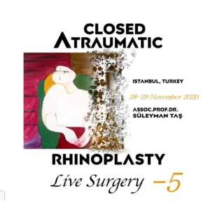 Closed Atraumatic Rhinoplasty Live Surgery DVD 5 / Digital