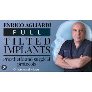 Full tilted implants Prosthetic and Surgical protocols 2023 (Osteocom)