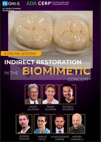 OHI-S Indirect Restoration in the Biomimetic Concept
