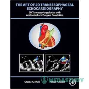 The Art Of 2D Transesophageal Echocardiography (PDF Book+ Videos )