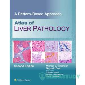 Atlas of Liver Pathology: A Pattern-Based Approach, 2nd Edition (EPUB)