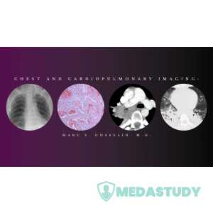 CMEScience Chest and Cardiopulmonary Imaging – Marc V. Gosselin, M.D (Videos + PDF)