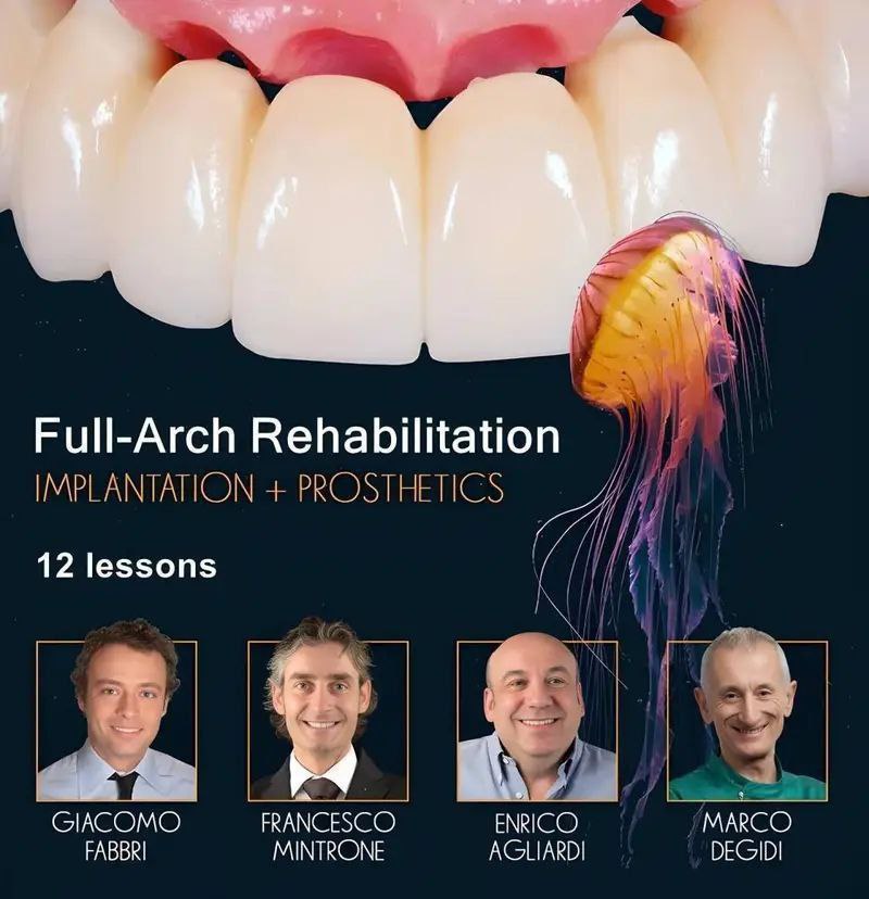 OHI-S Full-Arch Rehabilitation, Implantation and Prosthetics