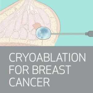 Houston Methodist Advanced Interventional Breast Imaging: Cryoablation, CEM, MRI, Stereotactic and Ultrasound Guidance 2025
