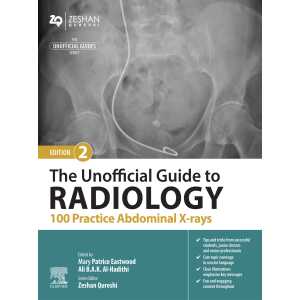 The Unofficial Guide to Radiology: 100 Practice Abdominal X-rays, 2nd Edition (EPUB)