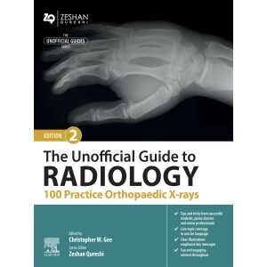 The Unofficial Guide to Radiology: 100 Practice Orthopaedic X-rays, 2nd Edition (EPUB)