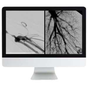 ARRS Case Review of Vascular and Interventional Radiology 2023 (Videos)