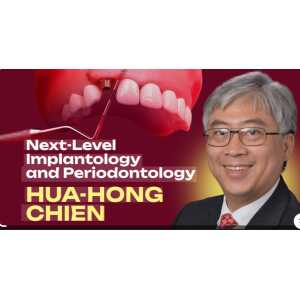 Next-Level Implantology and Periodontology-Mastering Immediate Implantation, Peri-implant Soft Tissue Augmentation, Sinus Lifting