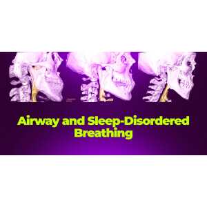OHI-S Airway and Sleep-Disordered Breathing: Integrating Myofunctional Protocols