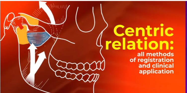 OHI-S Centric relation all methods of registration and clinical application