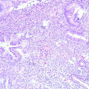 Oakstone Gynecologic Pathology 2026