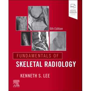 Fundamentals of Skeletal Radiology, 6th edition (True PDF)