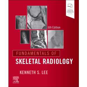 Fundamentals of Skeletal Radiology, 6th edition (True PDF)