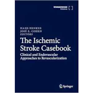 The Ischemic Stroke Casebook: Clinical and Endovascular Approaches to Revascularization (Original PDF from Publisher)
