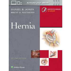 Master Techniques in Surgery: Hernia, 2nd Edition (EPUB)