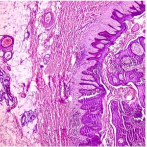 Dermatopathology: Masters of Pathology Series 2025 (Videos + PDF)