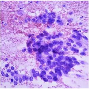 Cytopathology: Masters of Pathology Series 2026 (Videos + PDF)