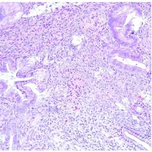 Gynecologic Pathology: Masters of Pathology Series 2026 (Videos + PDF)