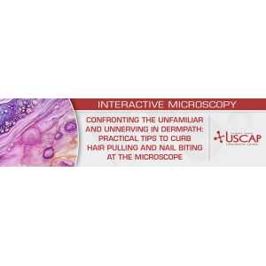 USCAP Confronting the Unfamiliar and Unnerving in Dermpath Practical Tips to Curb Hair Pulling and Nail Biting at the Microscope 2026