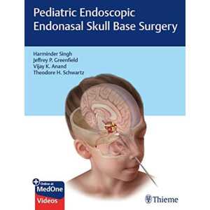 Pediatric Endoscopic Endonasal Skull Base Surgery (Original PDF from Publisher)