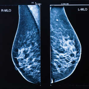 Oakstone UCSF Breast Imaging 2026