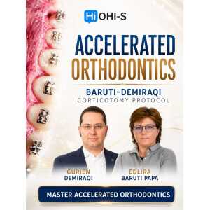 OHI-S Accelerated Orthodontic Baruti–Demiraqi Corticotomy Protocol